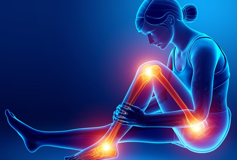 Rheumatoid arthritis