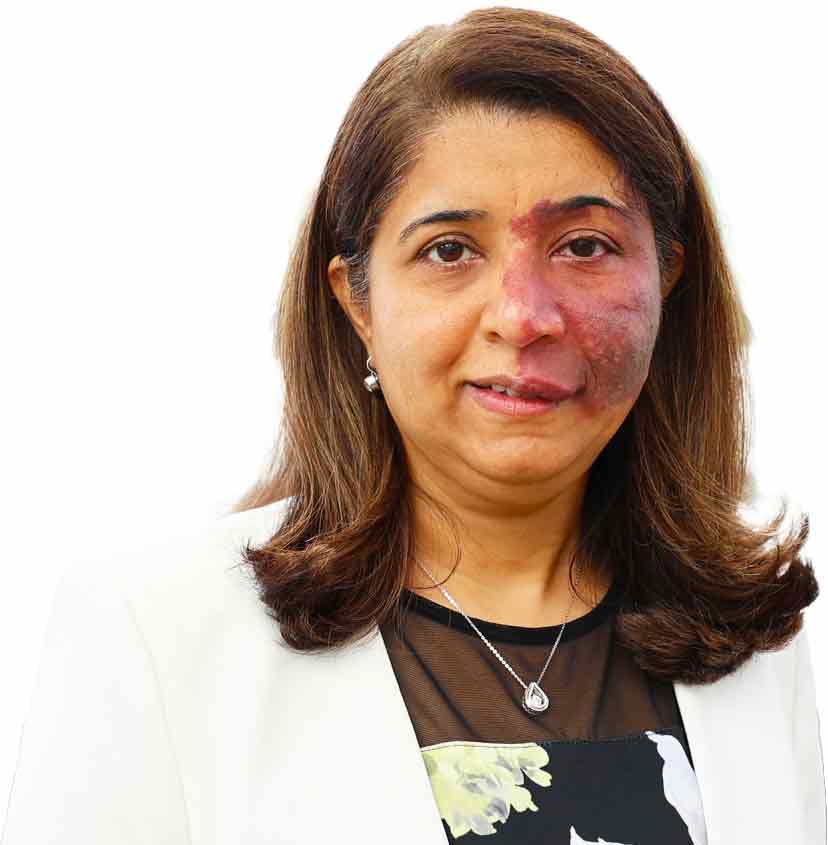 Dr Jayshri Shah, Consultant Hepatologist and Gastroenterologist at Benenden Hospital