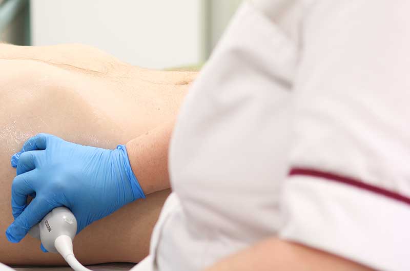 A sonographer performing an ultrasound at Benenden Hospital