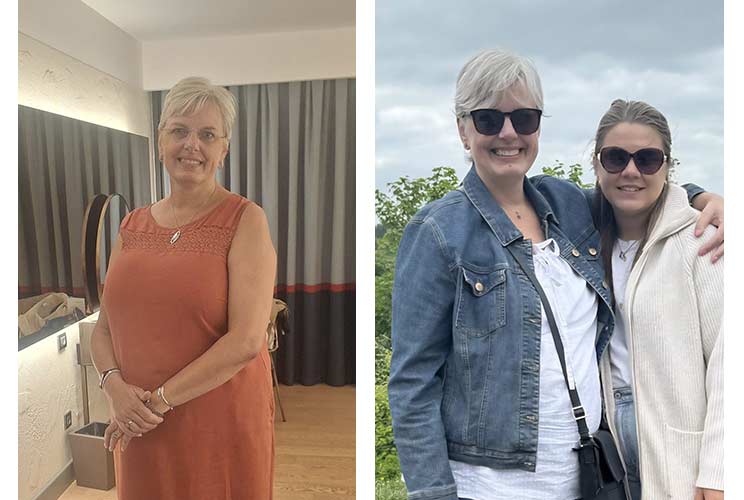 Kelly after breast reduction surgery